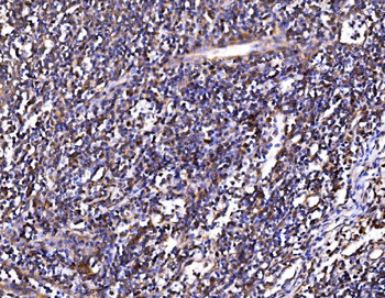 PSMD8 Rabbit Polyclonal Antibody