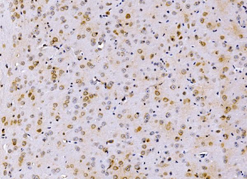 PSMD8 Rabbit Polyclonal Antibody
