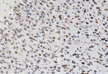 PSMD8 Rabbit Polyclonal Antibody