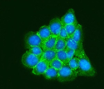 RPLP0 Rabbit Polyclonal Antibody