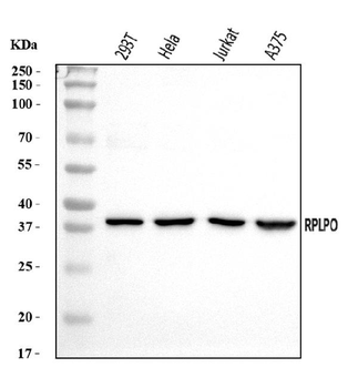 RPLP0 Rabbit Polyclonal Antibody