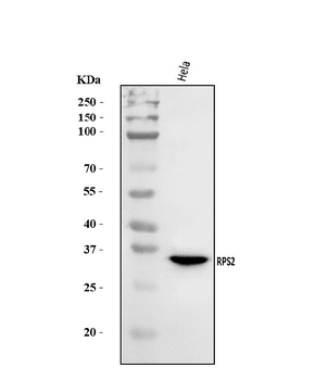 RPS2 Rabbit Polyclonal Antibody