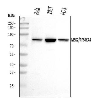 MSK2/RSK-B/RPS6KA4/RSK Rabbit Polyclonal Antibody
