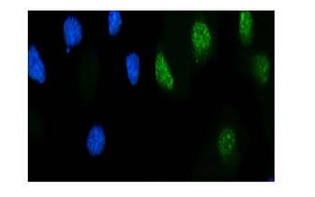 MSK2/RSK-B/RPS6KA4/RSK Rabbit Polyclonal Antibody