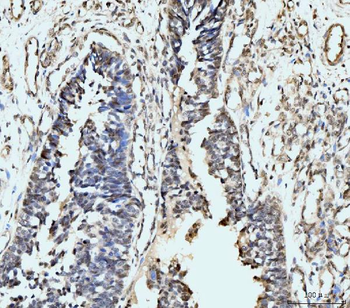 MSK2/RSK-B/RPS6KA4/RSK Rabbit Polyclonal Antibody