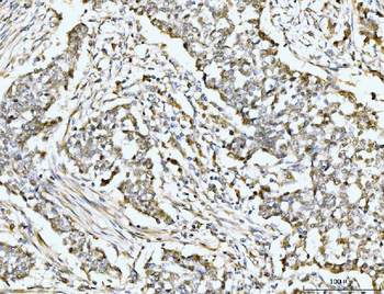 MSK2/RSK-B/RPS6KA4/RSK Rabbit Polyclonal Antibody