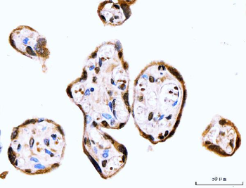 MSK2/RSK-B/RPS6KA4/RSK Rabbit Polyclonal Antibody