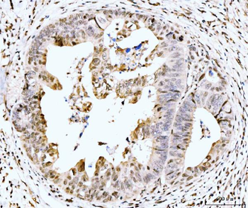 MSK2/RSK-B/RPS6KA4/RSK Rabbit Polyclonal Antibody