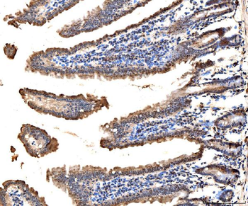 MSK2/RSK-B/RPS6KA4/RSK Rabbit Polyclonal Antibody