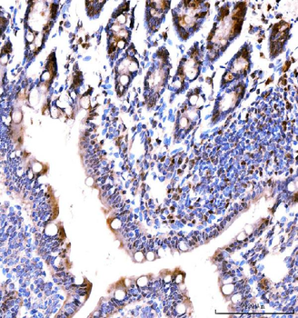 MSK2/RSK-B/RPS6KA4/RSK Rabbit Polyclonal Antibody