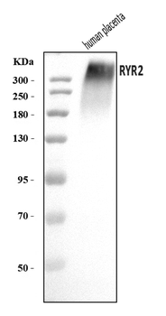 RYR2 Rabbit Polyclonal Antibody