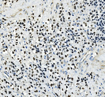 AP2 gamma/TFAP2C Rabbit Polyclonal Antibody
