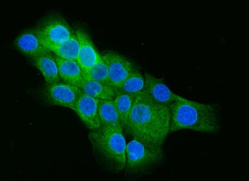 Cip4/TRIP10 Rabbit Polyclonal Antibody