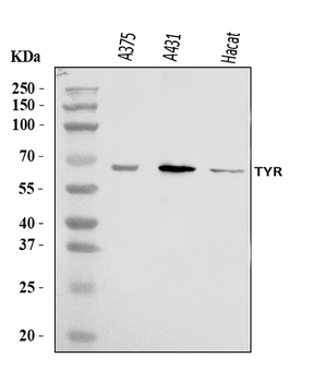 Tyrosinase/TYR Rabbit Polyclonal Antibody