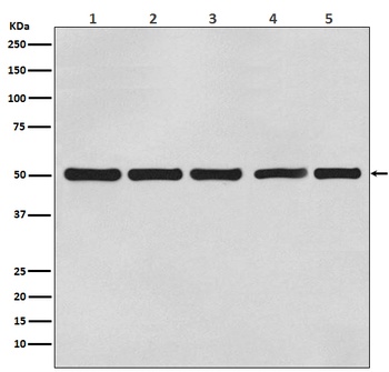 beta Tubulin Mouse Monoclonal Antibody