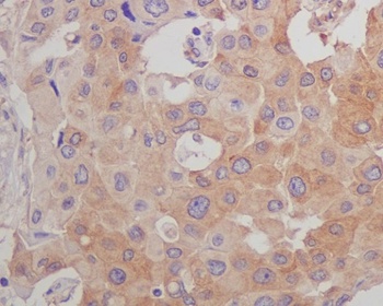beta Tubulin Mouse Monoclonal Antibody