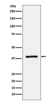 RASSF1 Rabbit Monoclonal Antibody