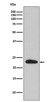 SNAP23 Rabbit Monoclonal Antibody