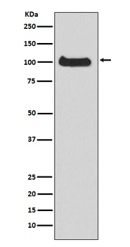 PKC mu Rabbit Monoclonal Antibody