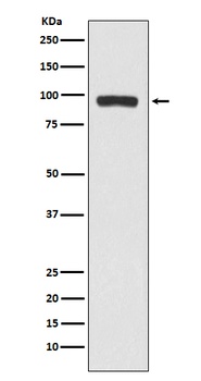 BCHE Rabbit Monoclonal Antibody