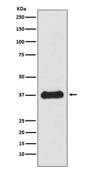 Follistatin Rabbit Monoclonal Antibody