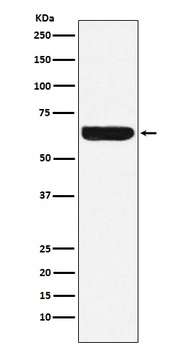 Placental alkaline phosphatase Rabbit Monoclonal Antibody