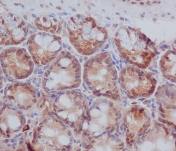 PKC beta 1 Rabbit Monoclonal Antibody