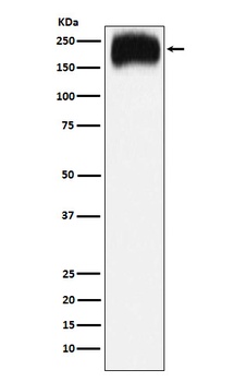 Niemann Pick C1 Rabbit Monoclonal Antibody