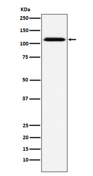 CD30 Rabbit Monoclonal Antibody