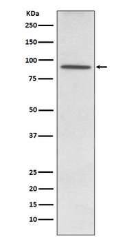 PDE4D Rabbit Monoclonal Antibody