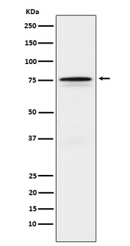FOXO1 Rabbit Monoclonal Antibody