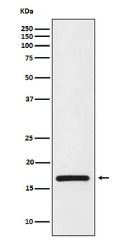 HMGA1 Rabbit Monoclonal Antibody