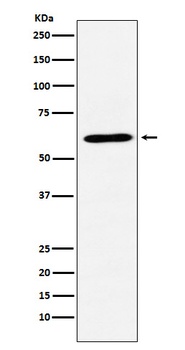 CRMP1 Rabbit Monoclonal Antibody