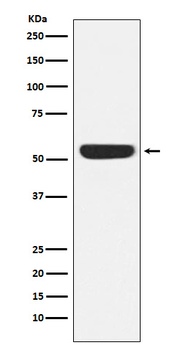 CAMKIV Rabbit Monoclonal Antibody