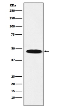 GABA A Receptor beta 1 Rabbit Monoclonal Antibody