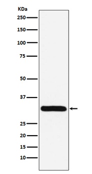 PSME1 Rabbit Monoclonal Antibody