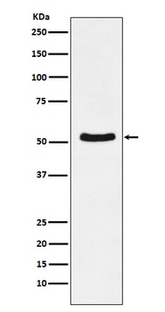 DDX6 Rabbit Monoclonal Antibody