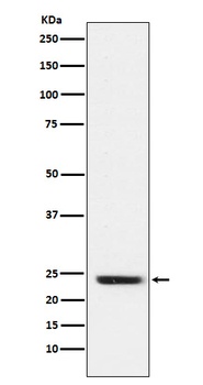 FNDC5 Rabbit Monoclonal Antibody