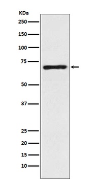 SLC6A1/GAT1 Rabbit Monoclonal Antibody