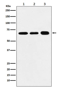 P70 S6 Kinase alpha Rabbit Monoclonal Antibody