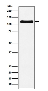 E1 Ubiquitin Activating Enzyme Rabbit Monoclonal Antibody