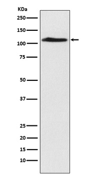 CHD1L Rabbit Monoclonal Antibody