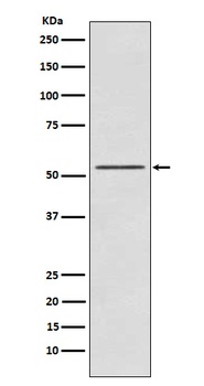 P70 S6 Kinase beta Rabbit Monoclonal Antibody