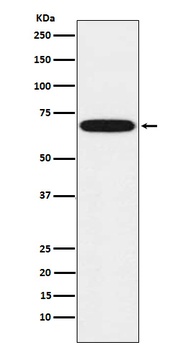 CYP1B1 Rabbit Monoclonal Antibody