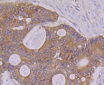 PON2 Rabbit Monoclonal Antibody