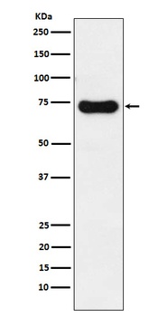 IRAK2 Rabbit Monoclonal Antibody