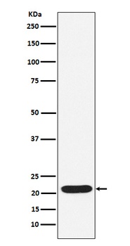 SOCS2 Rabbit Monoclonal Antibody