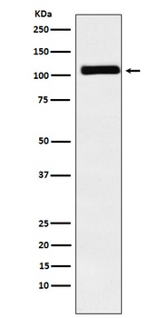 MIB1/DIP1 Rabbit Monoclonal Antibody