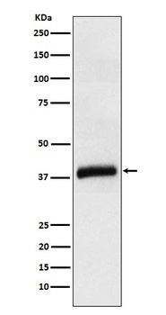 APOL1 Rabbit Monoclonal Antibody