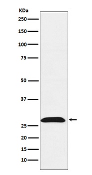 RhoGDI Rabbit Monoclonal Antibody